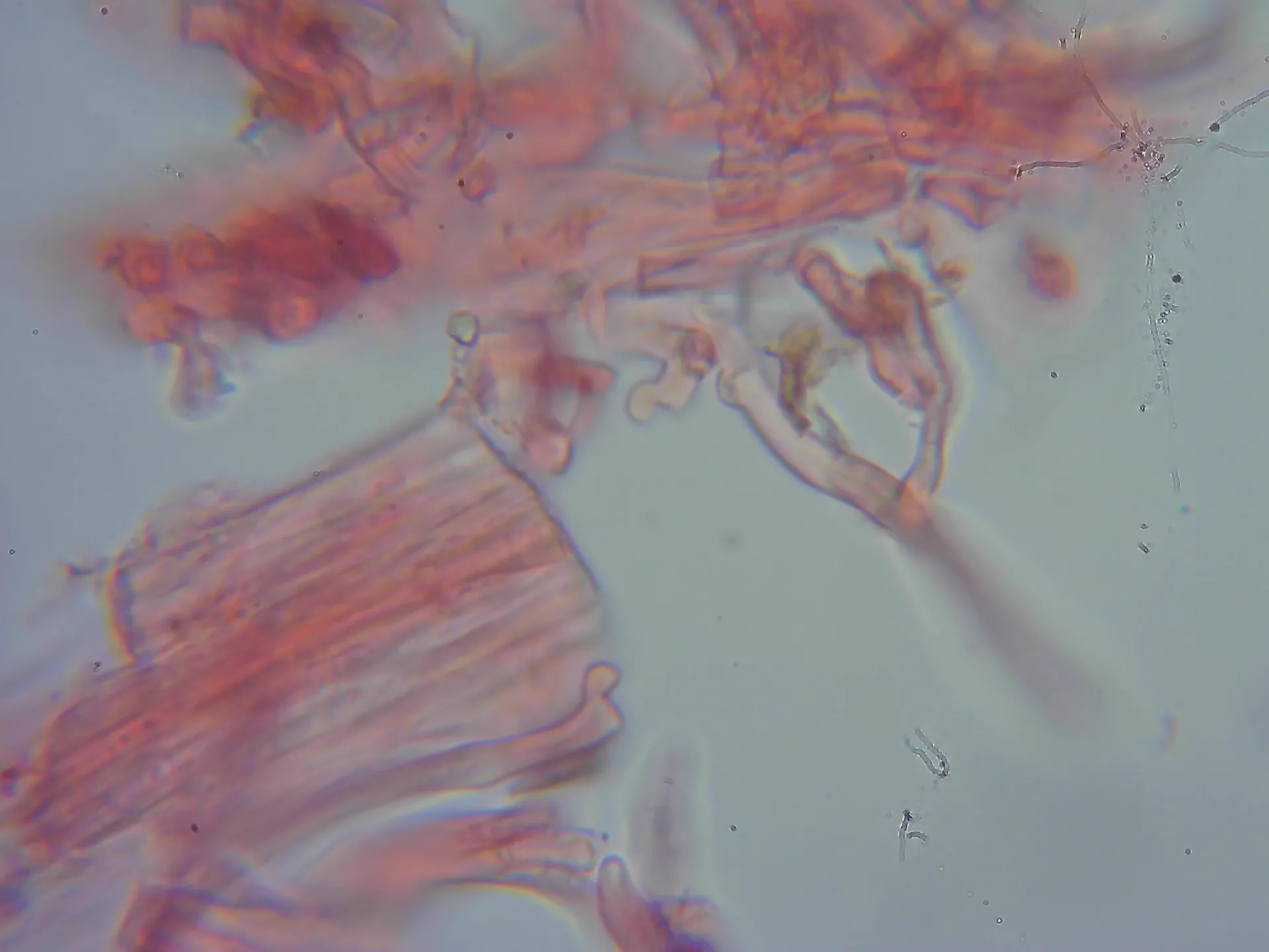 Microscopía de Lentinus crinitus - 10 - Fíbula 3